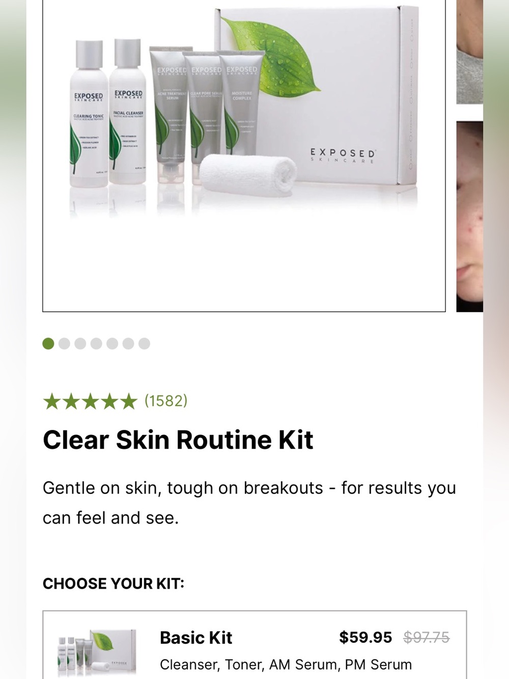 Clear Skin Routine Kit - White & Green